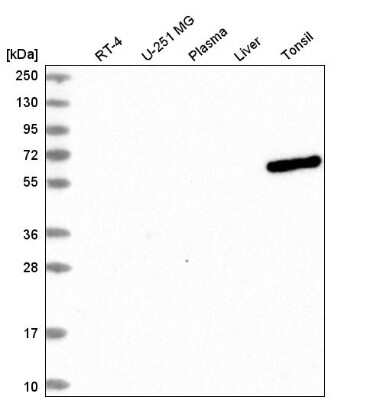 Western Blot: UTP3 Antibody [NBP2-58960]