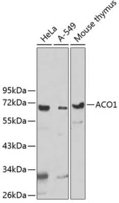 Western Blot: UTP3 AntibodyBSA Free [NBP2-93662]