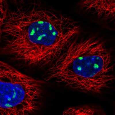 Immunocytochemistry/ Immunofluorescence: UTP6 Antibody [NBP1-88468]