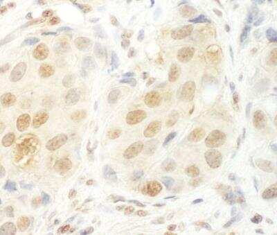 Immunohistochemistry-Paraffin: UTP6 Antibody [NBP1-30467]