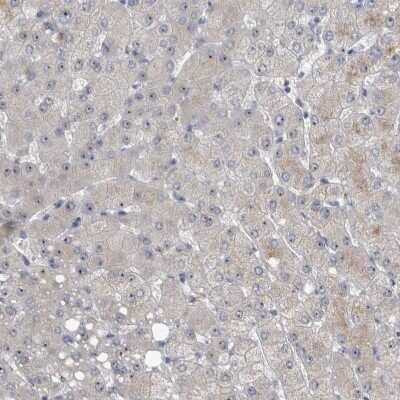 Immunohistochemistry-Paraffin: UTP6 Antibody [NBP1-88468]