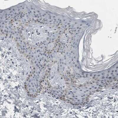 Immunohistochemistry-Paraffin: UTP6 Antibody [NBP1-88468]