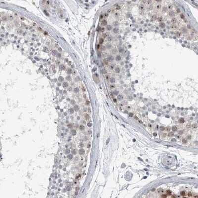 Immunohistochemistry-Paraffin: UTP6 Antibody [NBP1-88468]