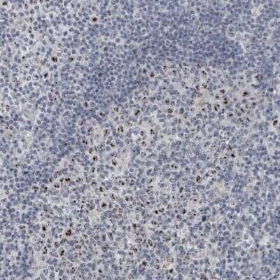 Immunohistochemistry-Paraffin: UTP6 Antibody [NBP1-88468]