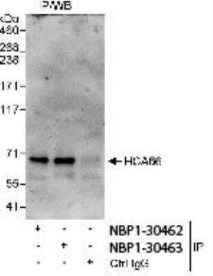 Immunoprecipitation: UTP6 Antibody [NBP1-30467]