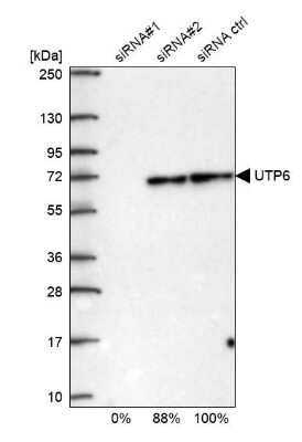 Western Blot: UTP6 Antibody [NBP1-88468]