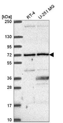 Western Blot: UTP6 Antibody [NBP2-55583]