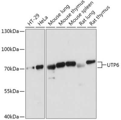 Western Blot: UTP6 AntibodyAzide and BSA Free [NBP2-94381]