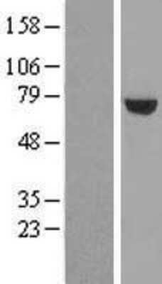 Western Blot: UTP6 Overexpression Lysate [NBL1-17680]