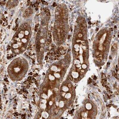 Immunohistochemistry-Paraffin: UTS2D Antibody [NBP1-80652]