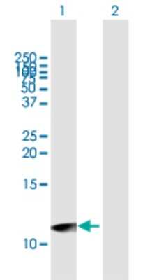 Western Blot: UTS2D Antibody [H00257313-B01P]