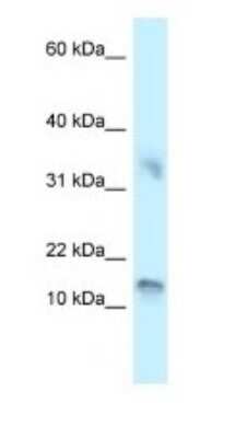 Western Blot: UTS2D Antibody [NBP1-79927]