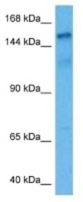 Western Blot: UTY Antibody [NBP3-11015]