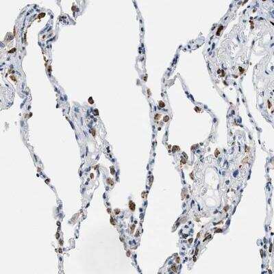 Immunohistochemistry: UVRAG Antibody [NBP1-86861]