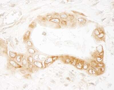 Immunohistochemistry-Paraffin: UVRAG Antibody [NBP1-18885]