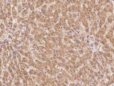 Immunohistochemistry-Paraffin: UVSSA Antibody [NBP3-06046]