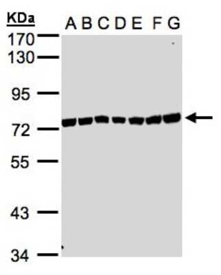 Western Blot: UVSSA Antibody [NBP1-32598]