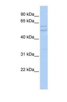 Western Blot: UXS1 Antibody [NBP1-69617]