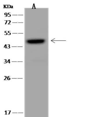 Western Blot: UXS1 Antibody [NBP3-06482]