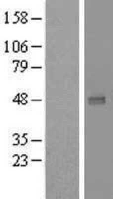 Western Blot: UXS1 Overexpression Lysate [NBL1-17685]