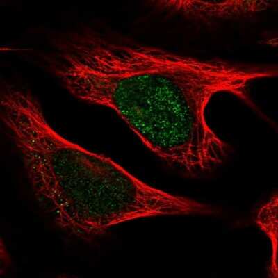 Immunocytochemistry/ Immunofluorescence: UXT Antibody [NBP2-31717]