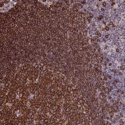 Immunohistochemistry-Paraffin: UXT Antibody [NBP2-31717]