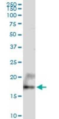 Western Blot: UXT Antibody [H00008409-B01P]