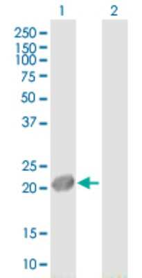 Western Blot: UXT Antibody [H00008409-B01P]