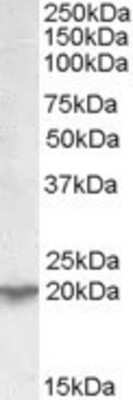 Western Blot: UXT Antibody [NBP1-00129]