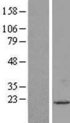 Western Blot: UXT Overexpression Lysate [NBL1-17686]