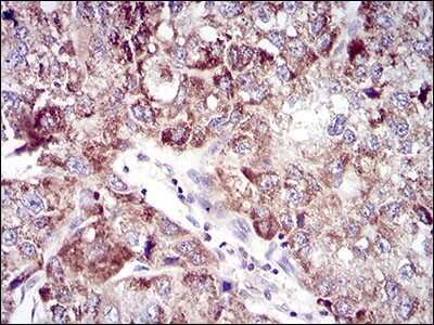 Immunohistochemistry-Paraffin: UbcH10/UBE2C Antibody (1F5D3) - BSA Free [NBP2-52580]