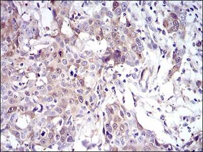 Immunohistochemistry-Paraffin: UbcH10/UBE2C Antibody (1F5D3) - BSA Free [NBP2-52580]