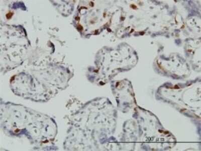 Immunohistochemistry-Paraffin: UbcH10/UBE2C Antibody (9D3) [H00011065-M01]