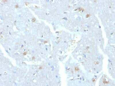 Immunohistochemistry-Paraffin: UbcH10/UBE2C Antibody (CPTC-UBE2C-1) - Azide and BSA Free [NBP3-08829]