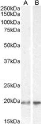 Western Blot: UbcH10/UBE2C Antibody [NB100-1084]