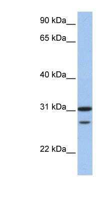 Western Blot: UbcH10/UBE2C Antibody [NBP1-58165]