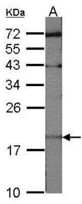 Western Blot: UbcH10/UBE2C Antibody [NBP2-20782]