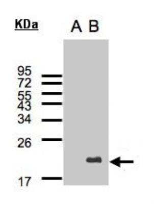 Western Blot: UbcH10/UBE2C Antibody [NBP2-20782]