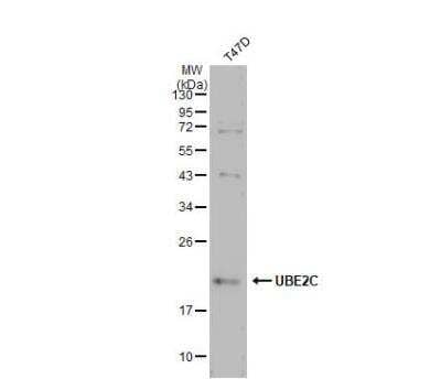 Western Blot: UbcH10/UBE2C Antibody [NBP2-20782]