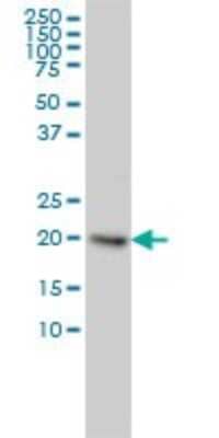 Western Blot: UbcH2/UBE2H Antibody (3C4-1A2) [H00007328-M01]