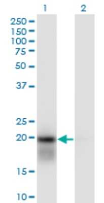 Western Blot: UbcH2/UBE2H Antibody (3C4-1A2) [H00007328-M01]