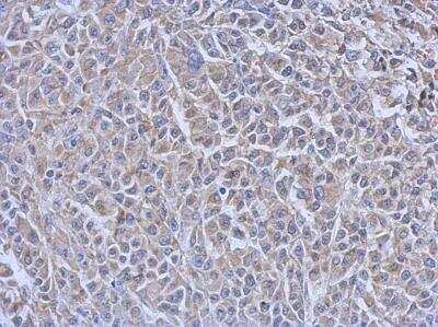 Immunohistochemistry-Paraffin: UBE2R1/CDC34 Antibody (14B5) [NB500-168]