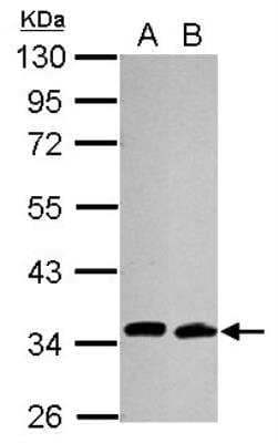 Western Blot: UBE2R1/CDC34 Antibody (14B5) [NB500-168]