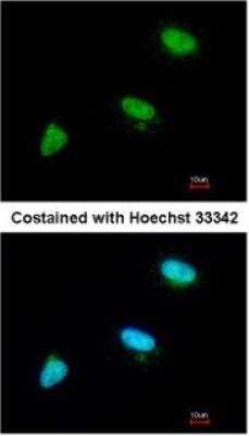 Immunocytochemistry/ Immunofluorescence: UBE2R1/CDC34 Antibody [NBP1-32153]