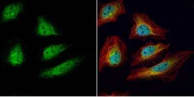 Immunocytochemistry/ Immunofluorescence: UBE2R1/CDC34 Antibody [NBP1-32153]