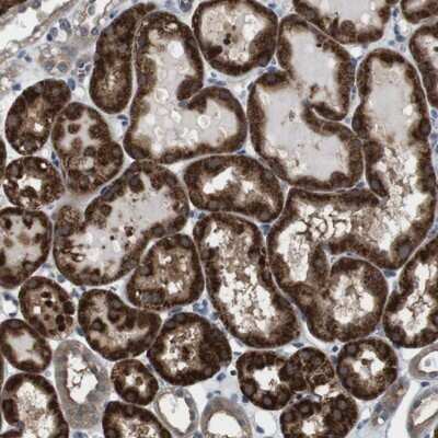 Immunohistochemistry-Paraffin: UBE2R1/CDC34 Antibody [NBP1-84946]
