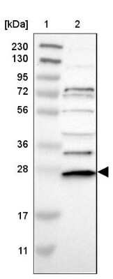 Western Blot: UBE2R1/CDC34 Antibody [NBP1-84946]