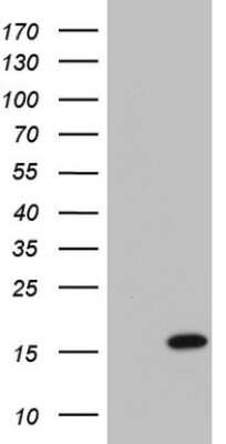 Western Blot: UbcH5a/UBE2D1 Antibody (OTI1E7) [NBP2-46269]