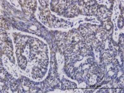 Immunohistochemistry-Paraffin: UbcH5a/UBE2D1 Antibody (2C6) [H00007321-M01]