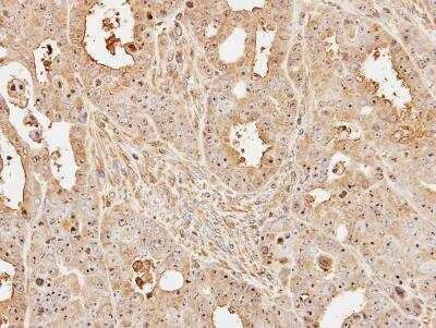 Immunohistochemistry-Paraffin: UbcH5a/UBE2D1 Antibody [NBP1-32734]